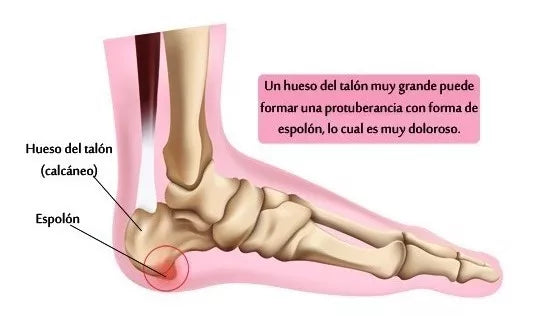 Plantillas Ortopédicas PasoFirme Pro